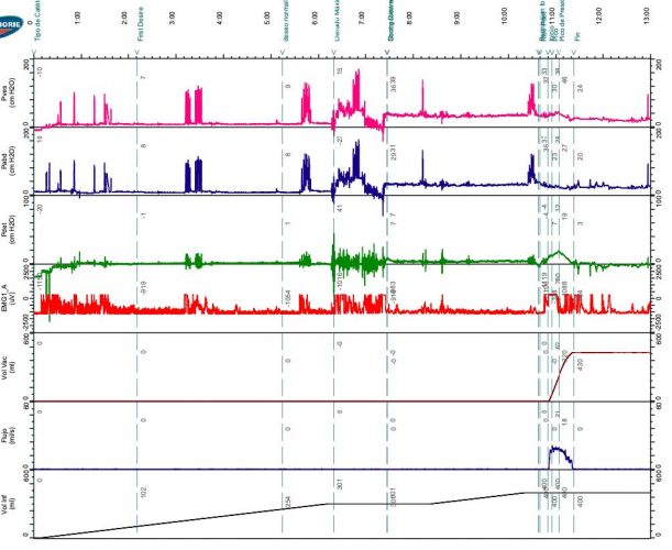 Fig. 3. Trazado Urodinámico Normal
