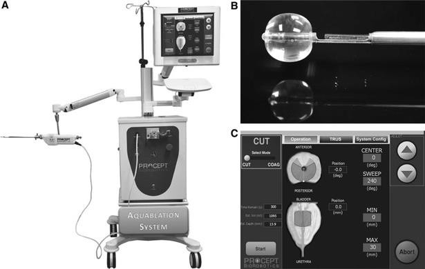 Fig. 24. Aquablation.