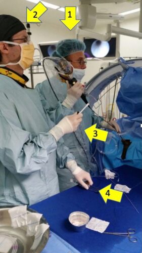 Fig. 9 Endourólogos: 1. Primer cirujano 2. Segundo cirujano 3. Manipulación de canastillo 4. Bomba de irrigación manual
