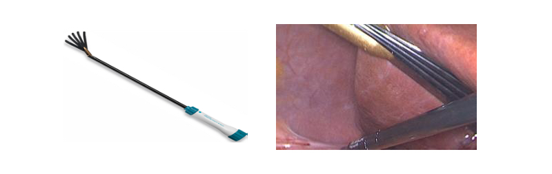 Fig. 10. Separador articulado “Endoretractor IIR”.