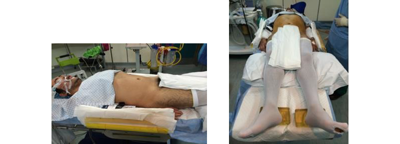 Fig. 2. Posición de Cirugía Pélvica