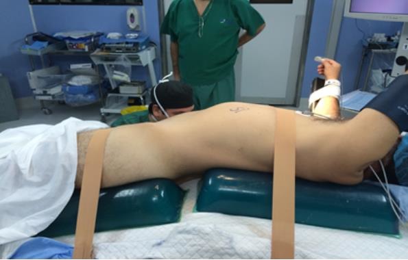 Fig. 4. Rollos de Gel para soporte en posición