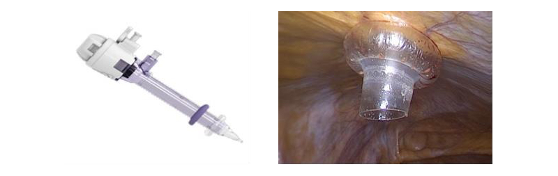 Fig. 9 Trócares transparentes romos, con mecanismos de auto retención.