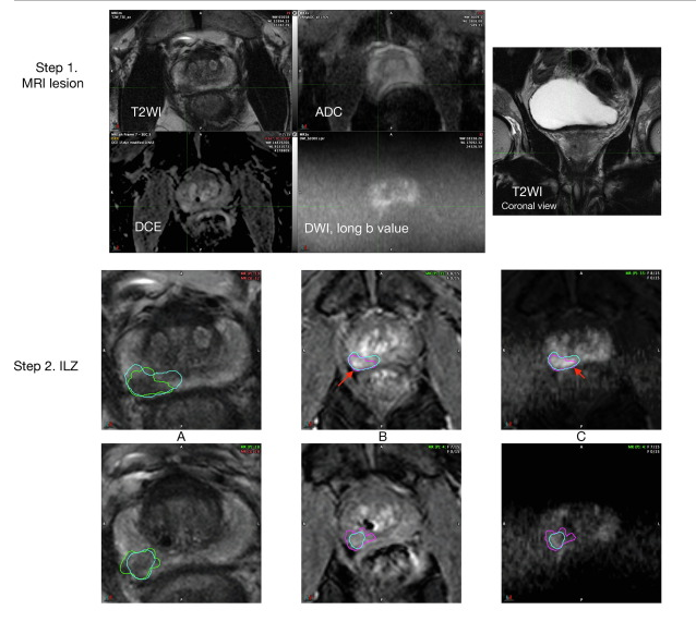A collage of images of a baby AI-generated content may be incorrect.