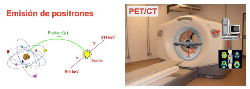 Fig.1. Emisión de Positrones del Pet/CT