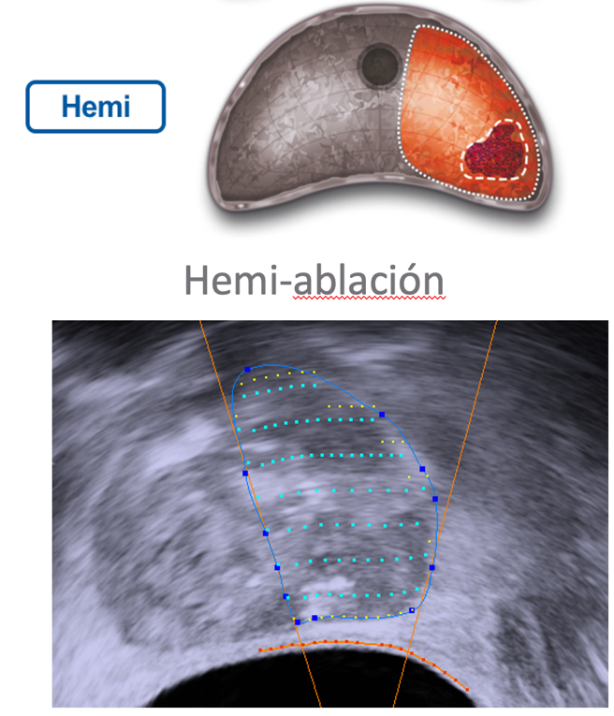 Imagen que contiene foto, nieve, esquiando, hombre Descripción generada automáticamente