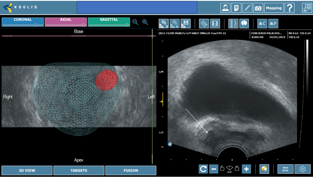 Imagen que contiene monitor, pantalla, interior, ordenador Descripción generada automáticamente