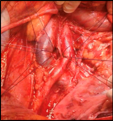 Insertando imagen...