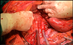 Insertando imagen...