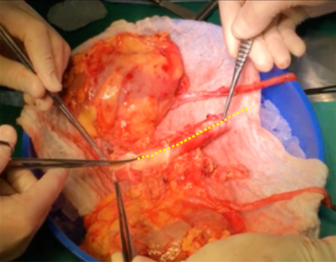 Insertando imagen...