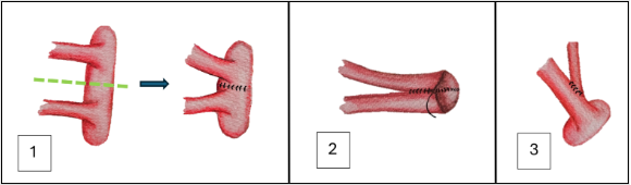 Insertando imagen...