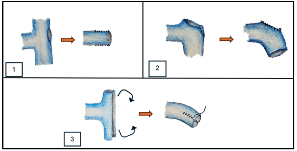 Insertando imagen...