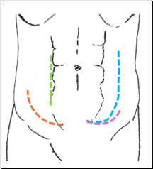 Insertando imagen...