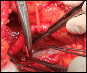 Insertando imagen...