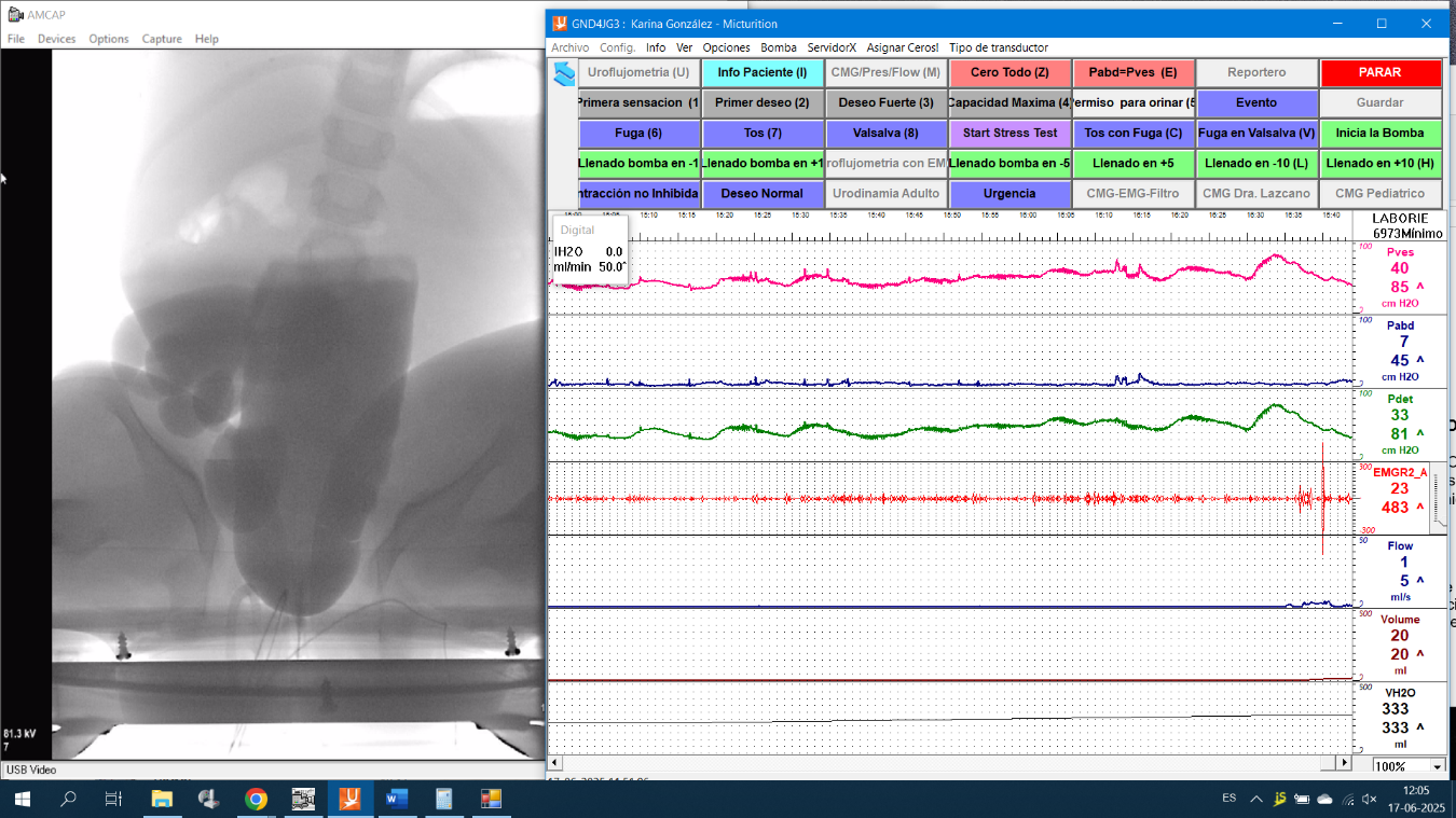 Interfaz de usuario gráfica, Aplicación, Tabla El contenido generado por IA puede ser incorrecto.
